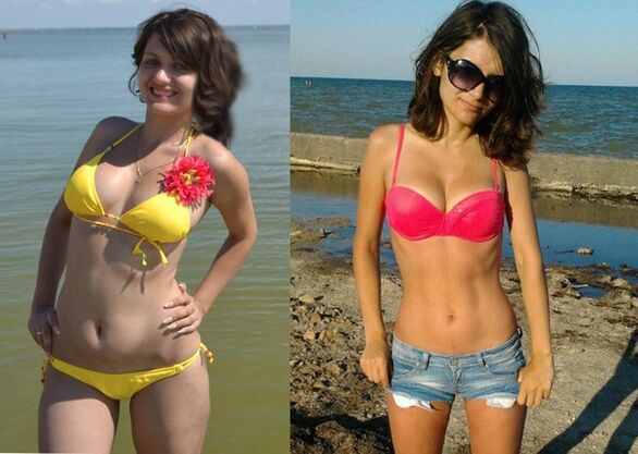 Anna perdió 10 kg con NexaSlim